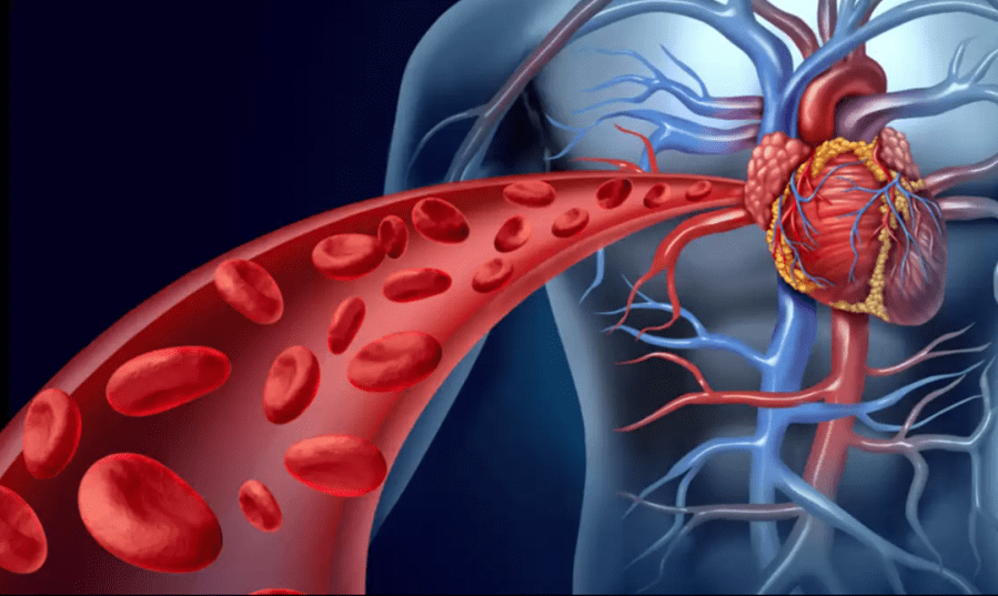 Hipertensión Arterial Sistémica